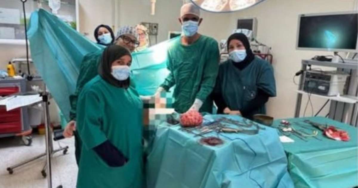 نجاح طبي بمستشفى قبلي: اجراء عملية دقيقة لاستئصال ورم كبير الحجم